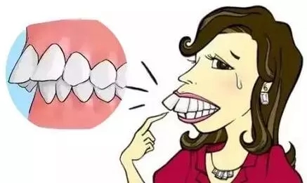 龅牙的人性格怎么样龅牙面相解析